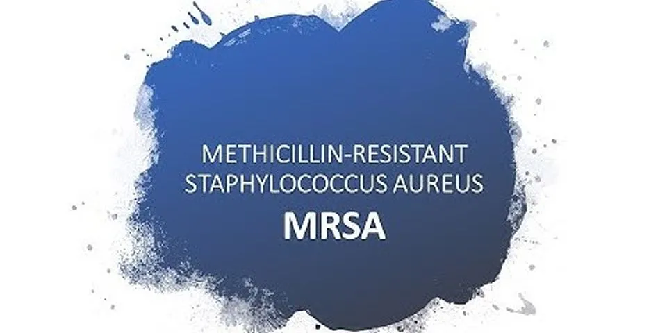 Community associated methicillin resistant staphylococcus aureus